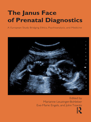 cover image of The Janus Face of Prenatal Diagnostics